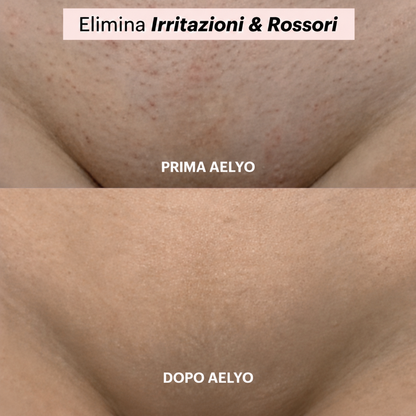 Rasoio 2 in 1 per bikini e corpo Aelyo™