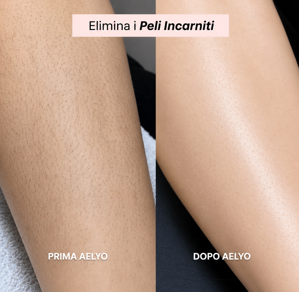 Rasoio 2 in 1 per bikini e corpo Aelyo™